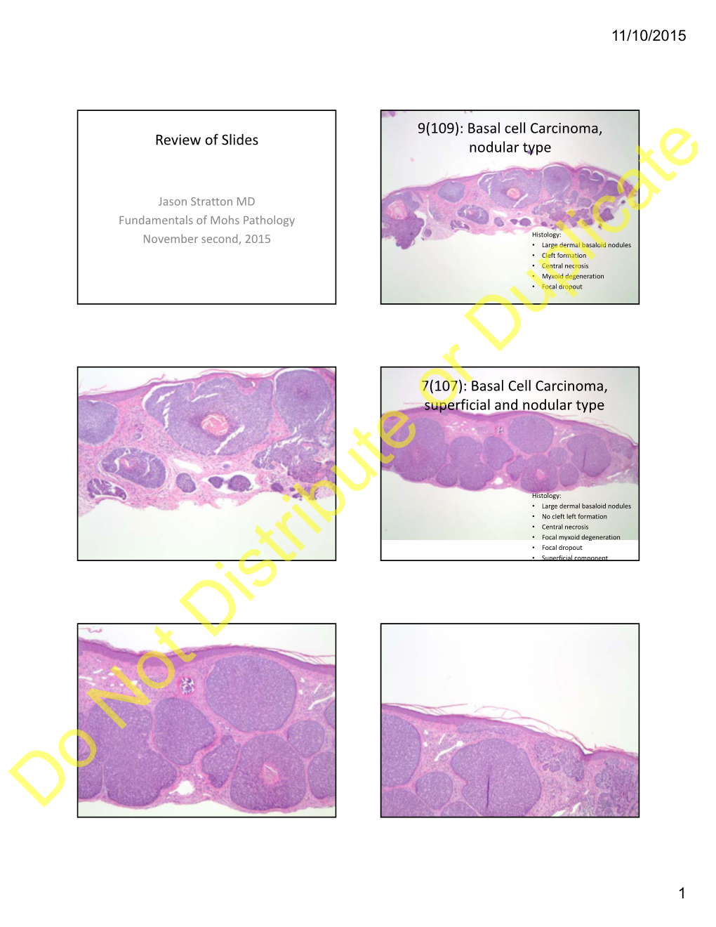 Basal Cell Carcinoma, Superficial and Nodular Typeor