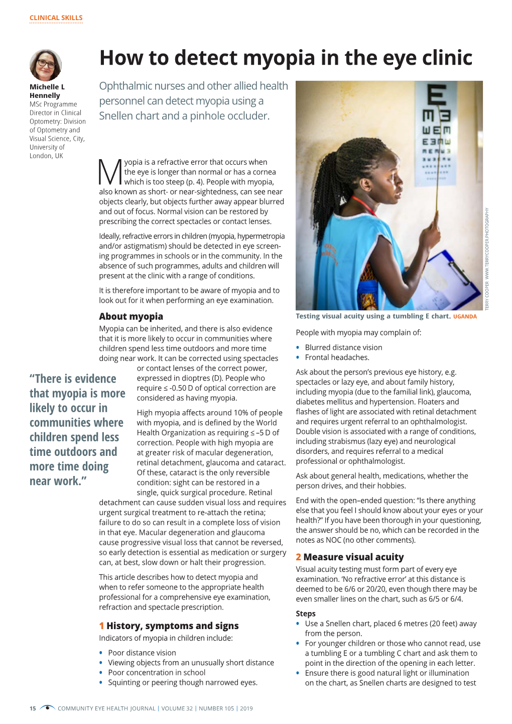 How to Detect Myopia in the Eye Clinic