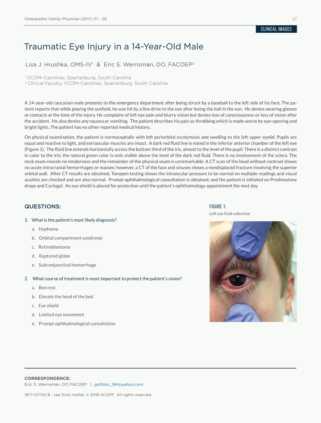 Traumatic Eye Injury in a 14-Year-Old Male