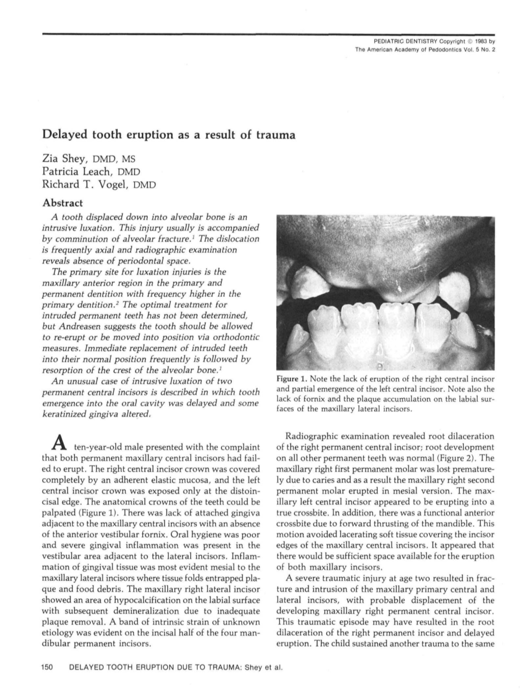 Delayed Tooth Eruption As a Result of Trauma