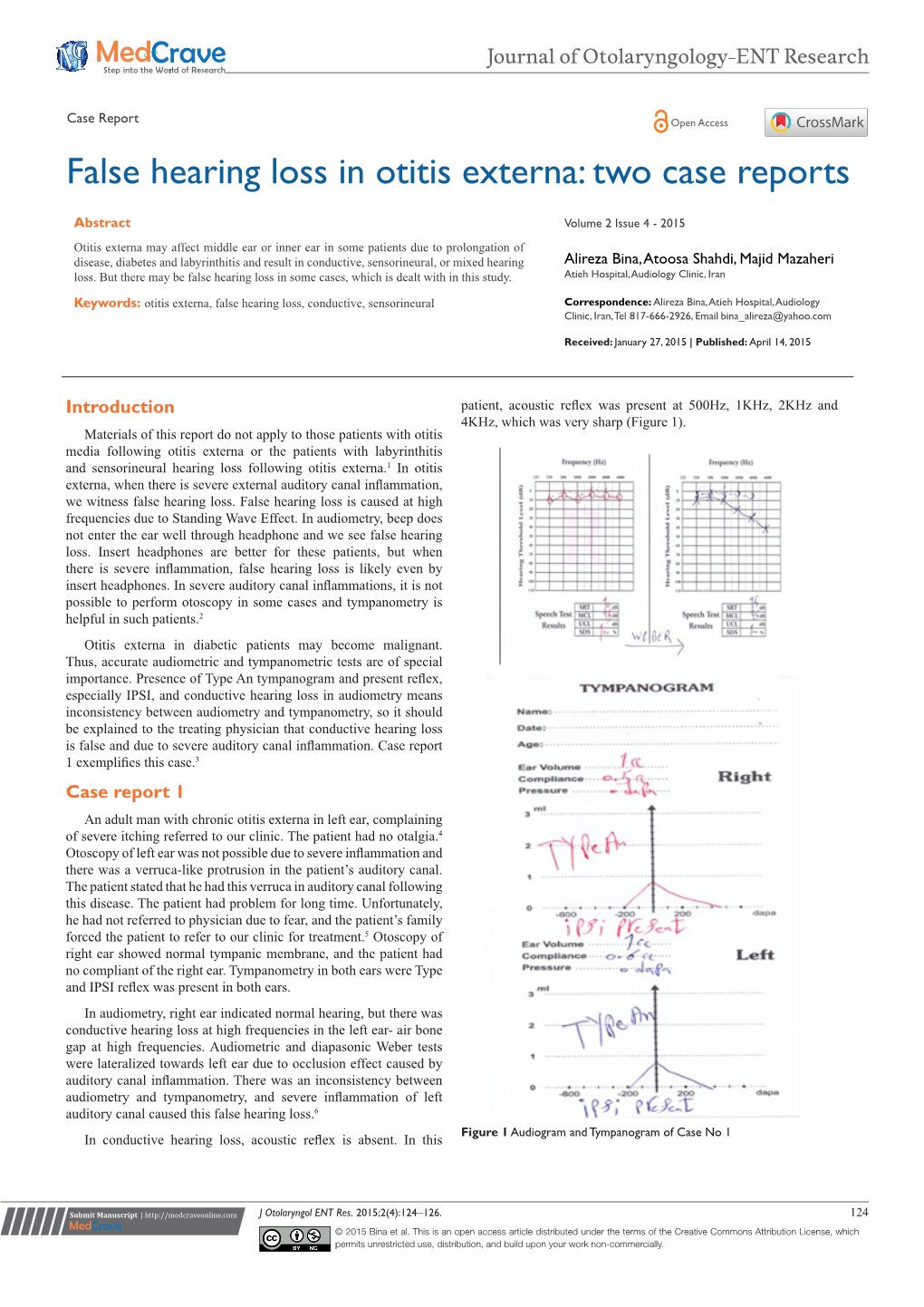 False Hearing Loss in Otitis Externa: Two Case Reports