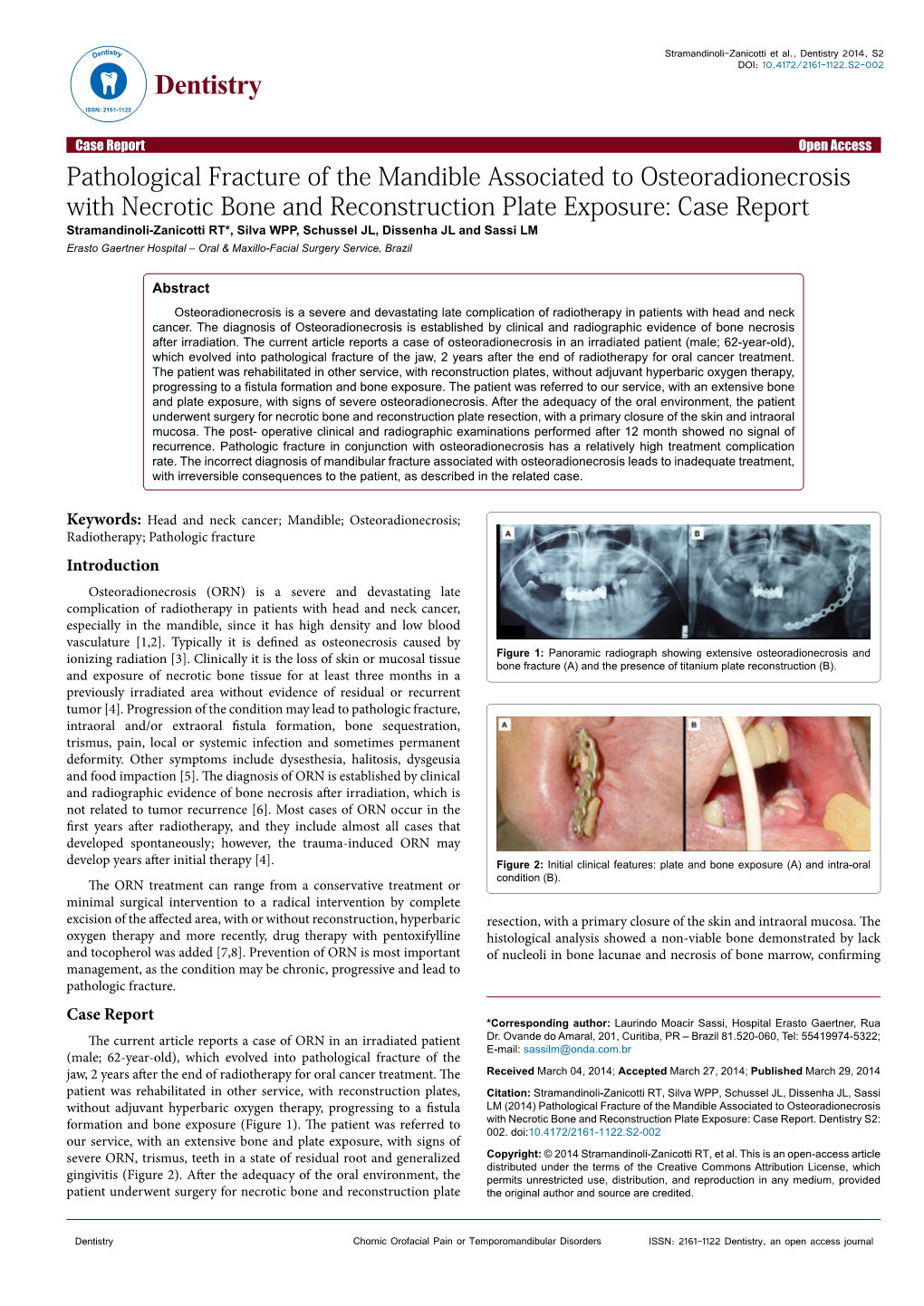 Pathological Fracture of the Mandible Associated to Osteoradionecrosis