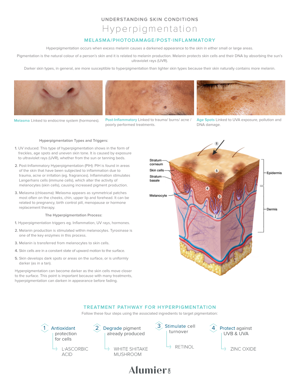 Alumiermd Melasma Skin Condition Sheet