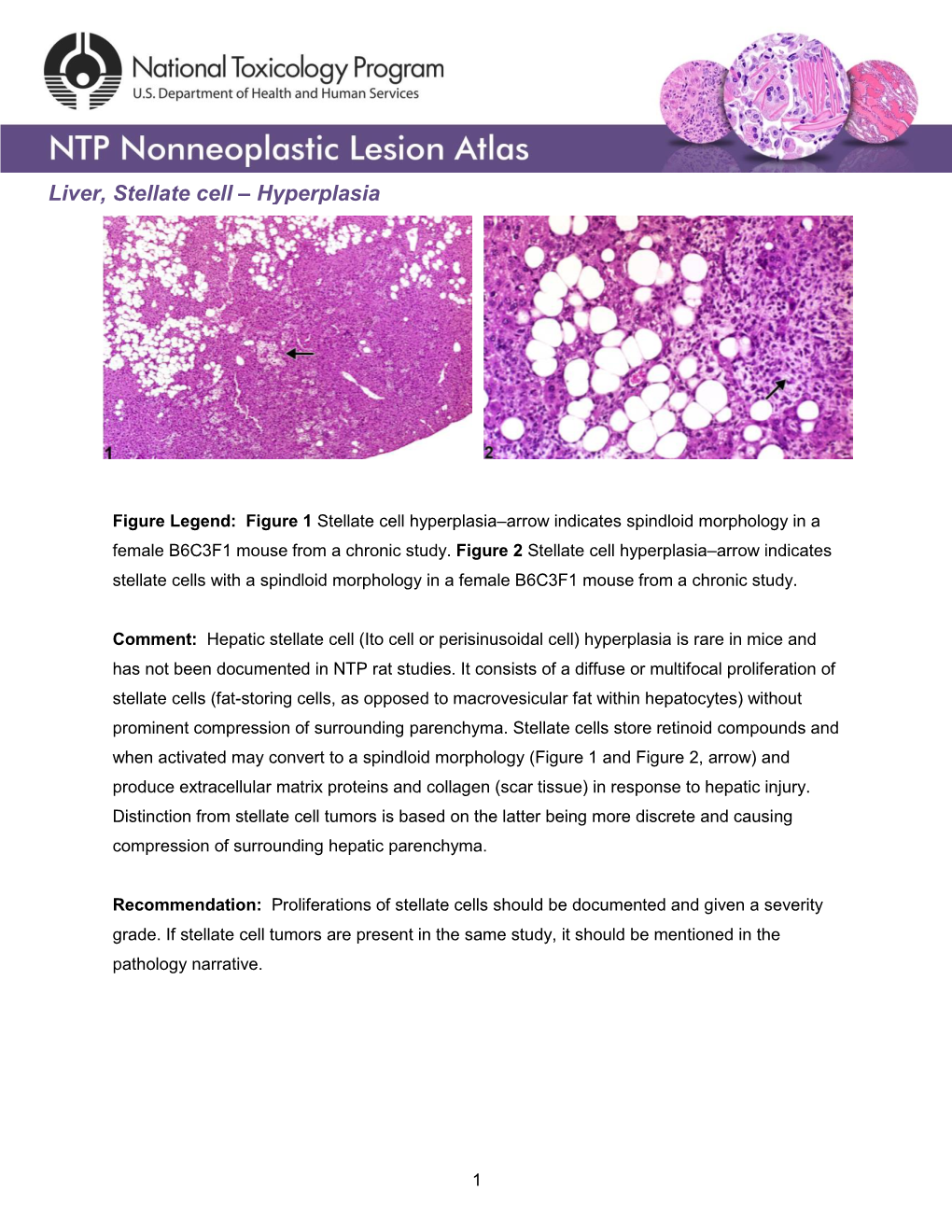 Liver, Stellate Cell – Hyperplasia