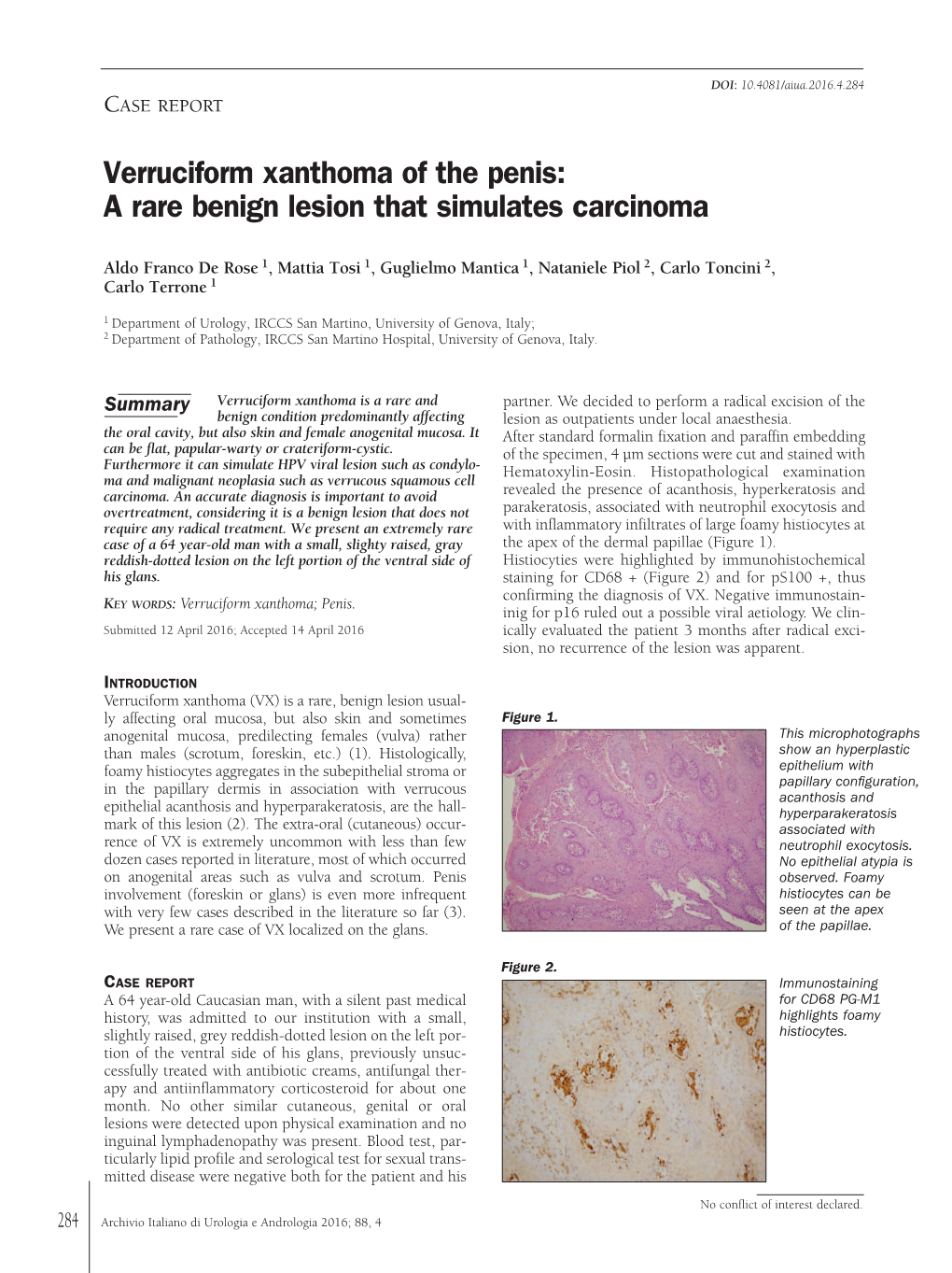 Verruciform Xanthoma of the Penis: a Rare Benign Lesion That Simulates Carcinoma