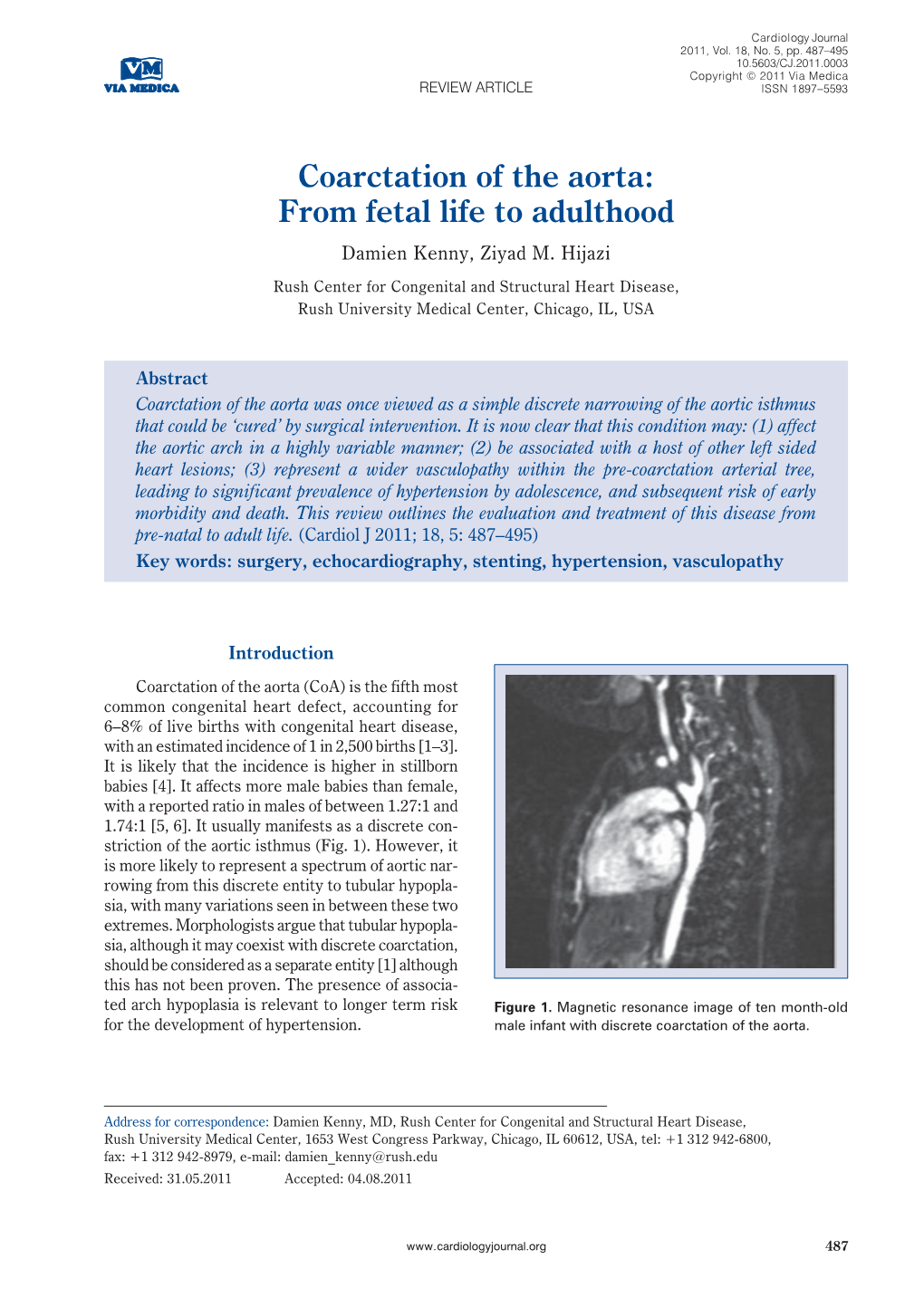 Coarctation of the Aorta: from Fetal Life to Adulthood