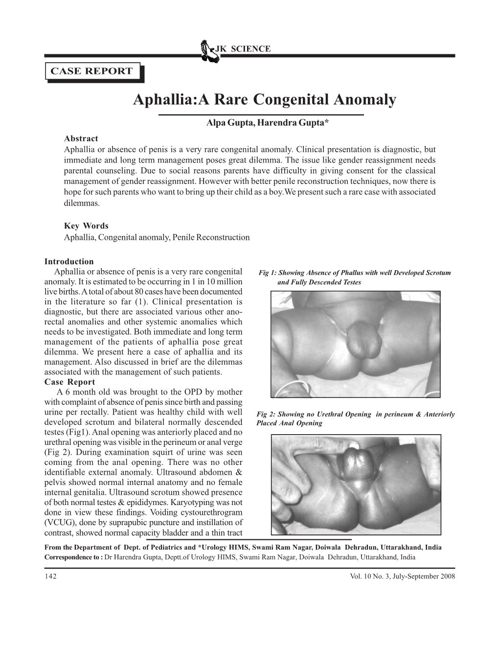 Aphallia:A Rare Congenital Anomaly