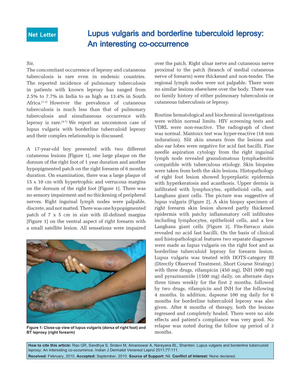 Lupus Vulgaris and Borderline Tuberculoid Leprosy: an Interesting Co-Occurrence