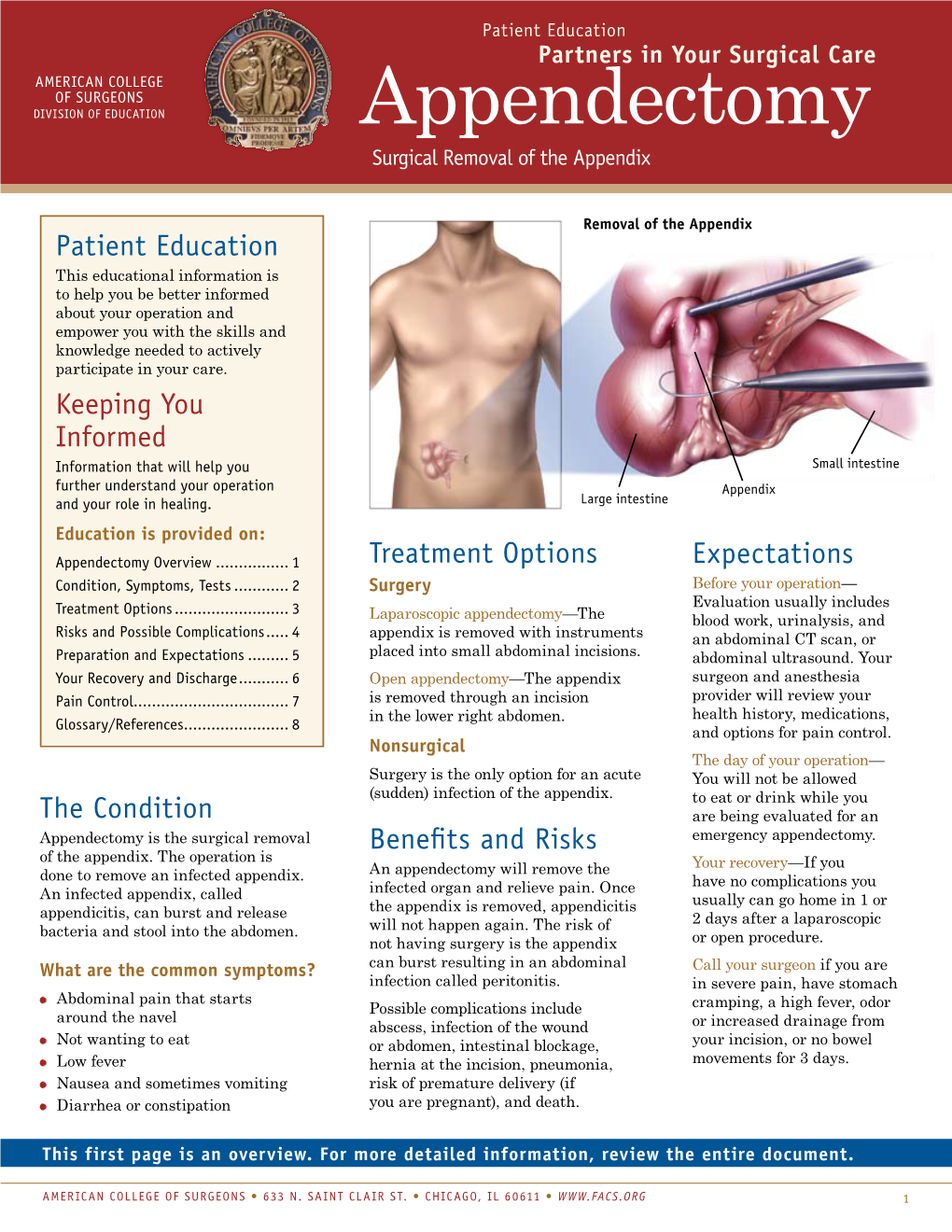 Appendectomy Surgical Removal of the Appendix