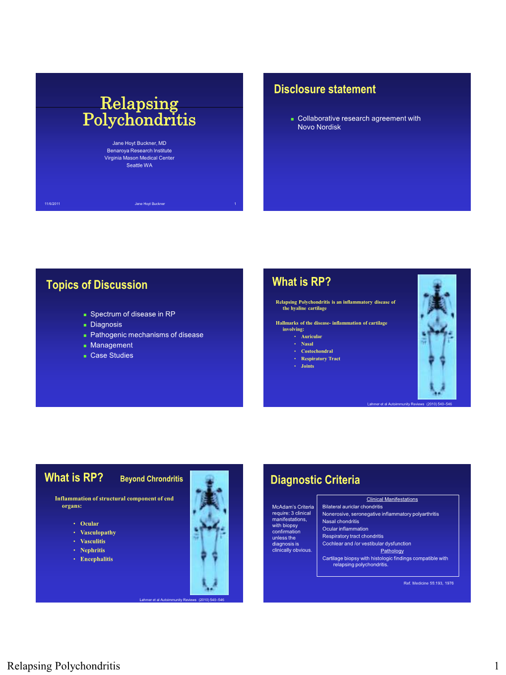 Relapsing Polychondritis