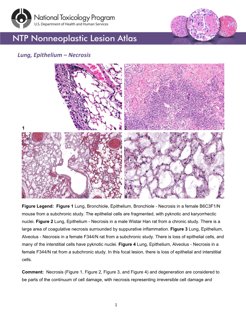 Lung, Epithelium – Necrosis