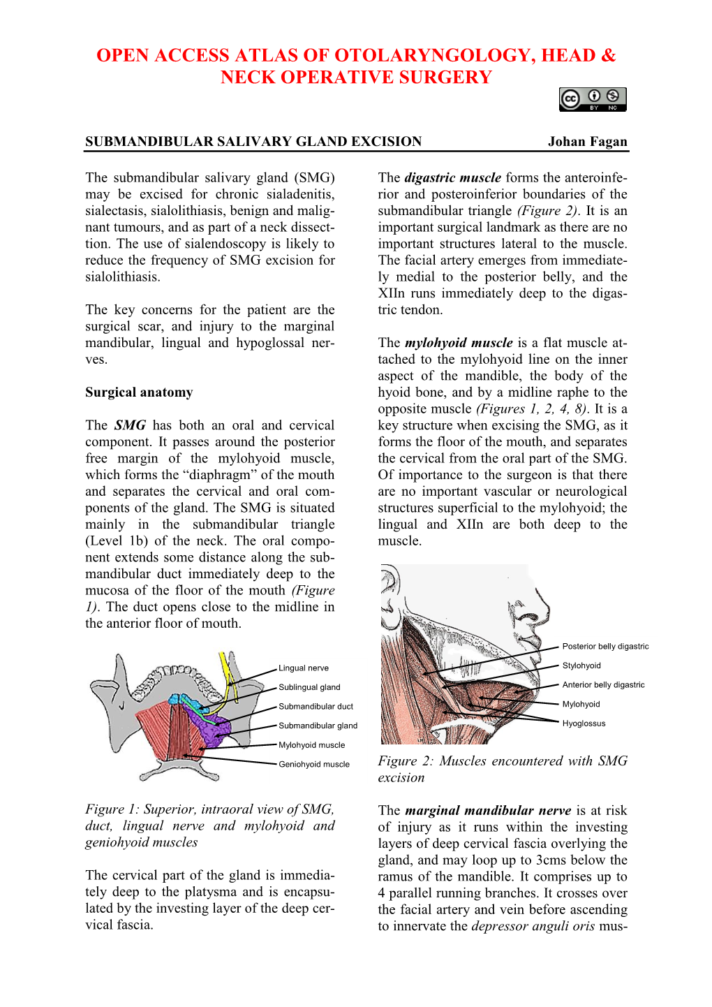 Submandibular Gland Excision