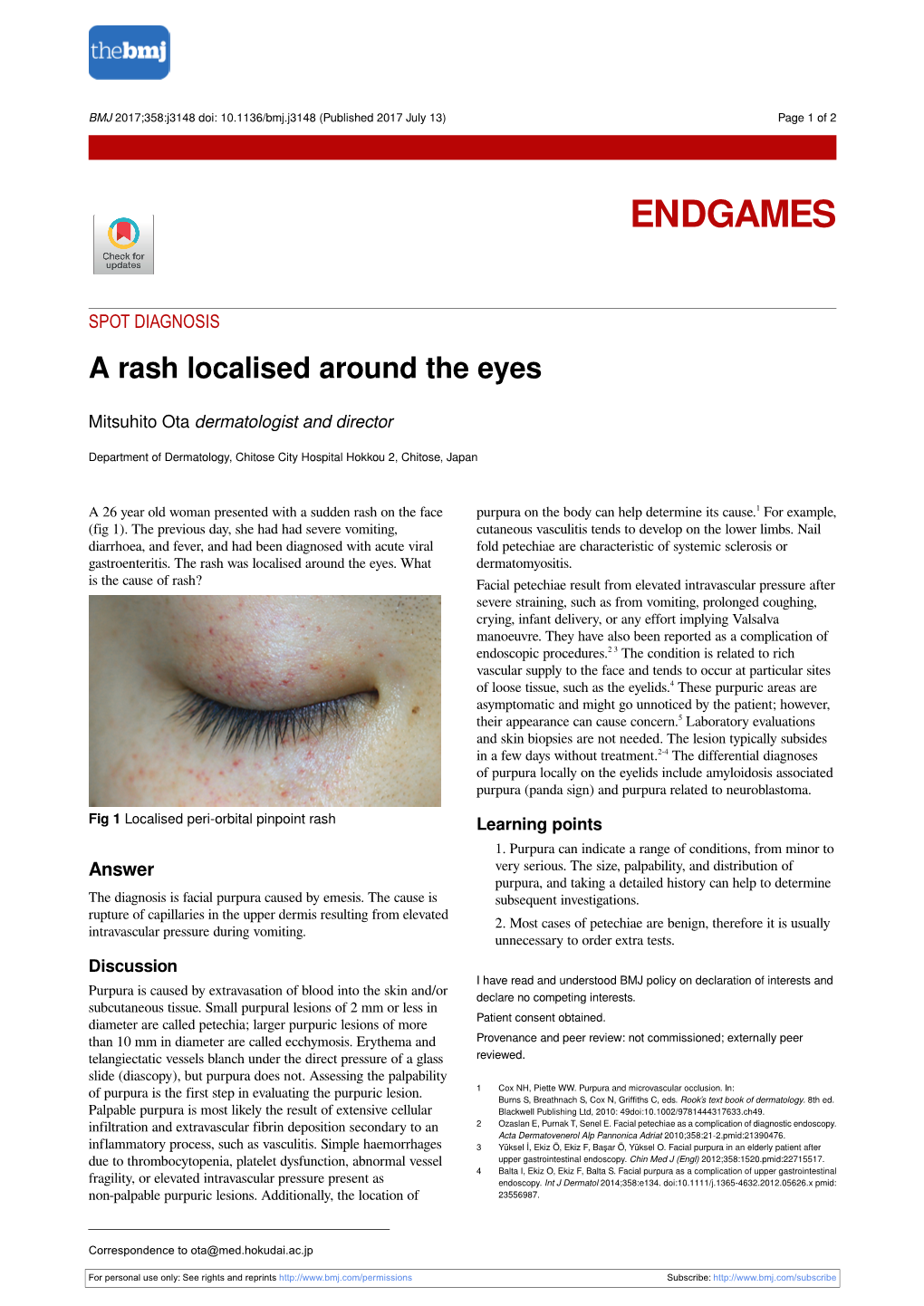 A Rash Localised Around the Eyes