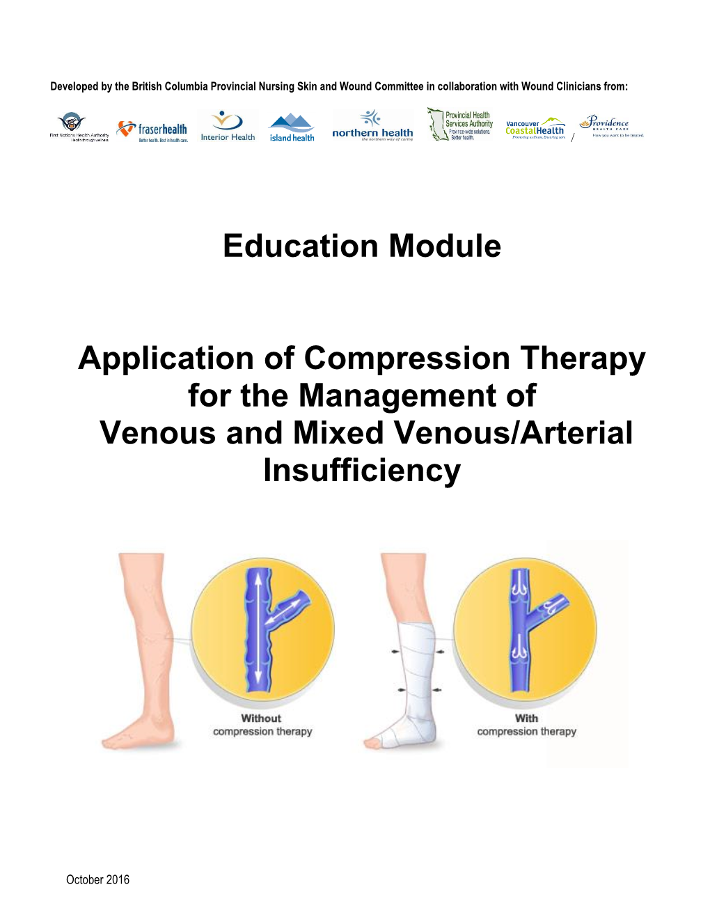 Compression-Therapy