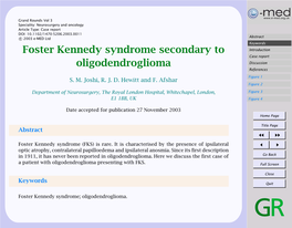 Foster Kennedy Syndrome Secondary to Oligodendroglioma