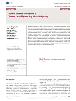 Bladder and Liver Involvement of Visceral Larva Migrans May Mimic Malignancy