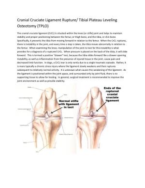 Cranial Cruciate Ligament Rupture/ Tibial Plateau Leveling Osteotomy (TPLO)