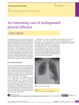 An Interesting Case of Undiagnosed Pleural Effusion Case Report