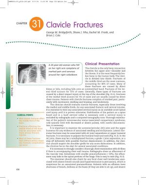 Clavicle Fractures George M