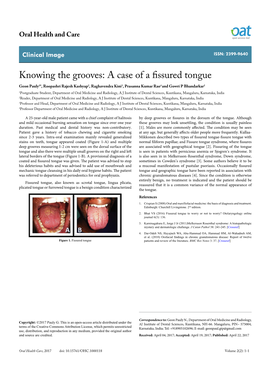 A Case of a Fissured Tongue