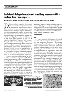 Unilateral Delayed Eruption of Maxillary Permanent First Molars