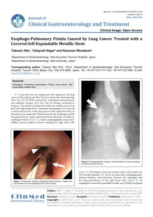 Esophago-Pulmonary Fistula Caused by Lung Cancer Treated with a Covered Self-Expandable Metallic Stent