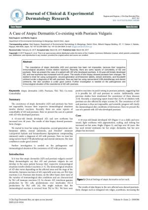 A Case of Atopic Dermatitis Co-Existing with Psoriasis Vulgaris