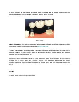 A Dental Bridge Is a Fixed Dental Prosthesis Used to Replace One Or Several Missing Teeth by Permanently Joining an Artificial T