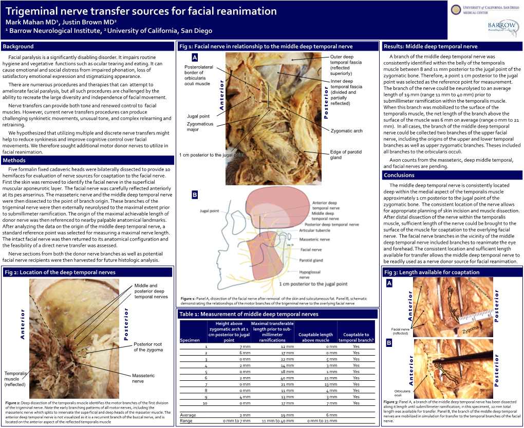 Measurement of Middle Deep Temporal Nerves