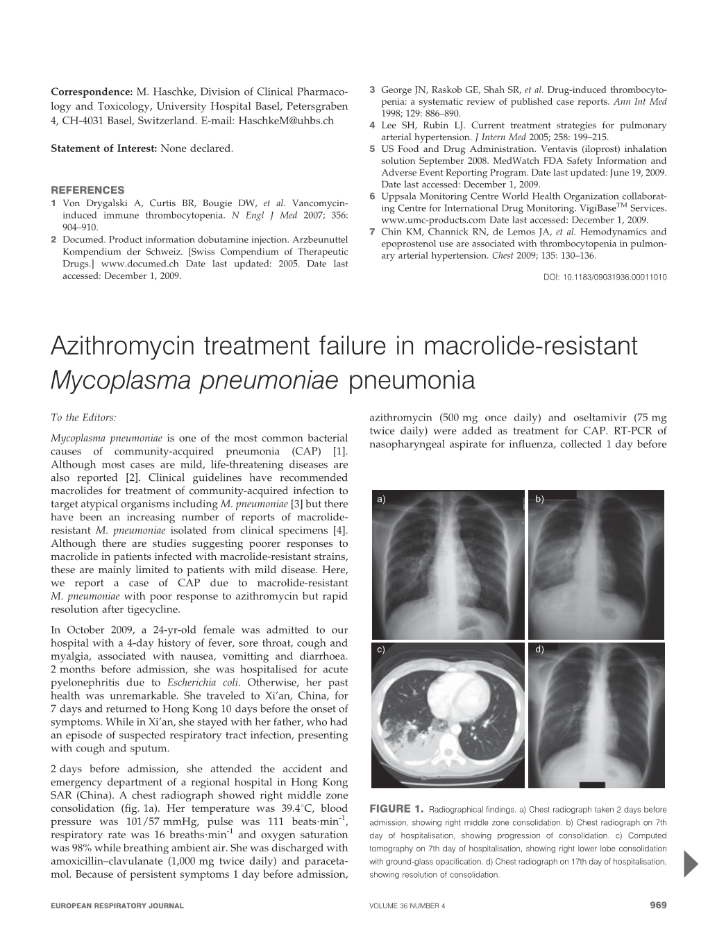 Azithromycin Treatment Failure in Macrolide-Resistant Mycoplasma Pneumoniae Pneumonia