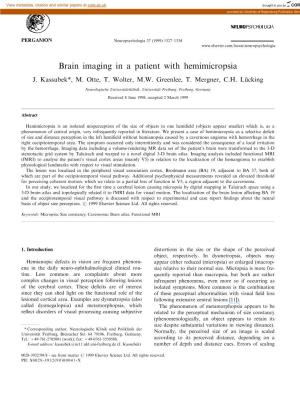 Brain Imaging in a Patient with Hemimicropsia