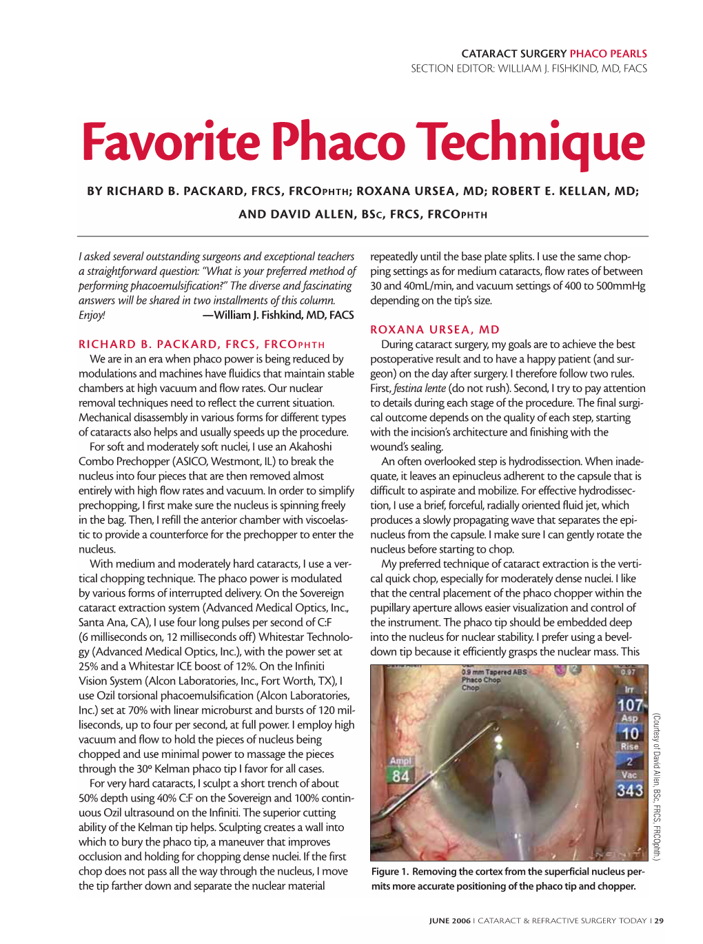 Favorite Phaco Technique