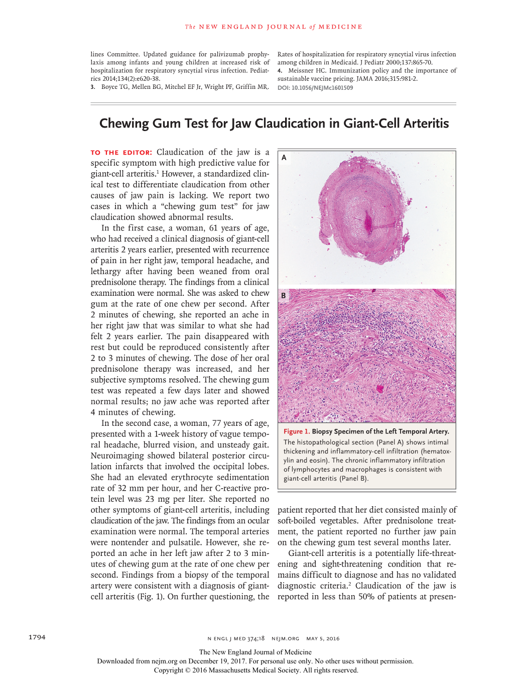 Chewing Gum Test for Jaw Claudication in Giant-Cell Arteritis