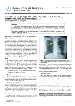 Paratracheal Stripe Sign”: the Chest X-Ray Itself Voices Pathology