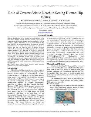 Role of Greater Sciatic Notch in Sexing Human Hip Bones