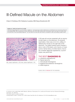 Ill-Defined Macule on the Abdomen