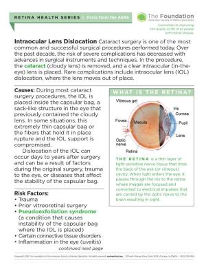 Intraocular Lens Dislocation Cataract Surgery Is One of the Most Common and Successful Surgical Pro­Cedures Performed Today