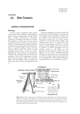 Skin Tumors Process, Starting at Young Age (20 Years), with the Based on Its Differentiation Into Keratinocytic, Tumors Developing 30 to 40 Years Later (Fig 22-2)