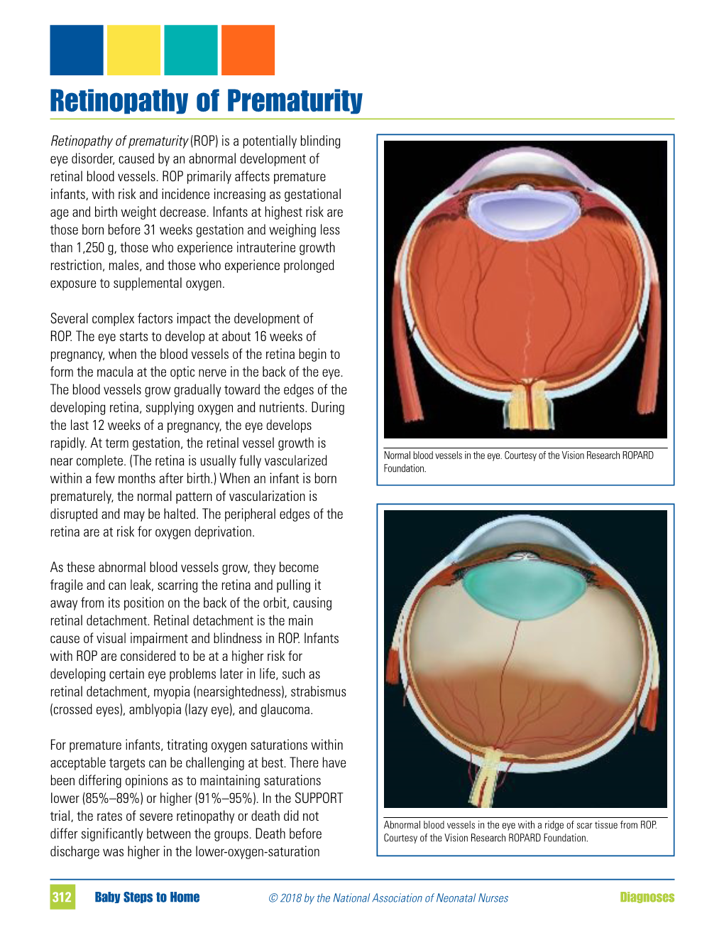 Retinopathy of Prematurity