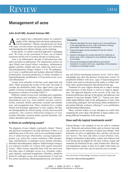 Management of Acne