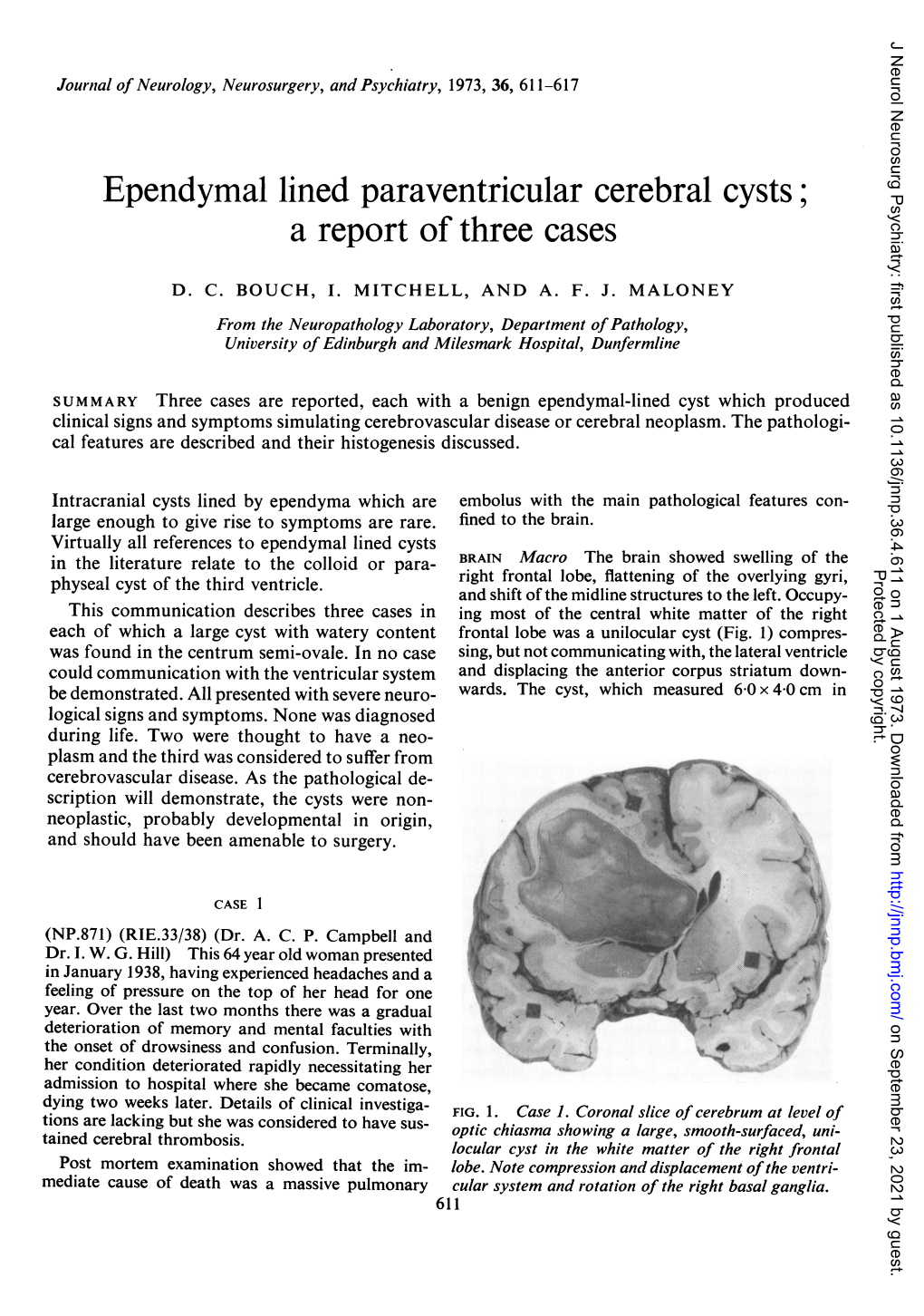 Ependymal Lined Paraventricular Cerebral Cysts; a Report of Three Cases