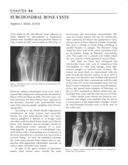 Subchondral Bone Cysts Seen in Conjunction with Osteoarthritis Or Other Joint Damage, from Intra- Osseous Ganglia Or Synovial Cysts of Bone
