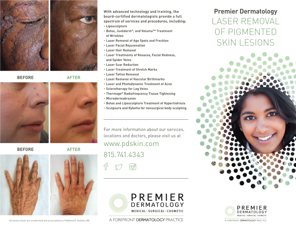 Laser Removal of Pigmented Skin Lesions Is a Relatively Easy Procedure