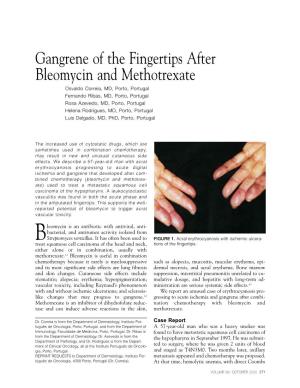 Gangrene of the Fingertips After Bleomycin and Methotrexate