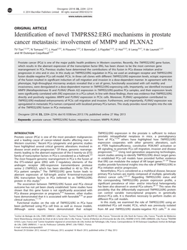 Identification of Novel TMPRSS2:ERG Mechanisms in Prostate Cancer Metastasis: Involvement of MMP9 and PLXNA2
