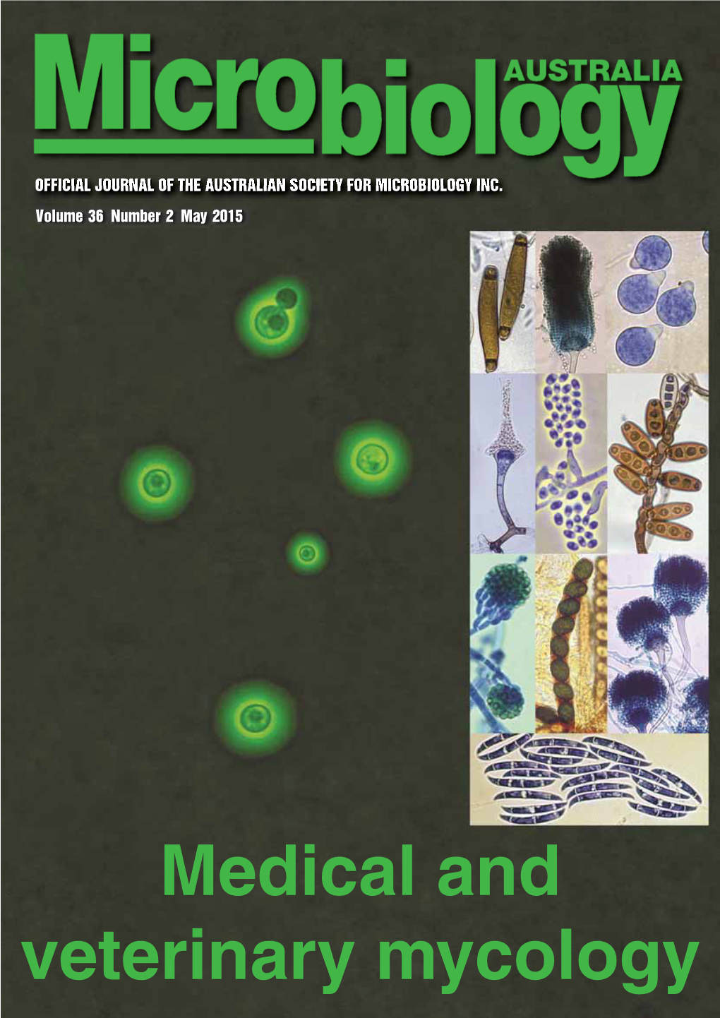 Medical and Veterinary Mycology Maximum Performance Solutions Customisable MIC of Bacteria,Mycobacteriaandyeasts,Ensuringaccurateﬁrsttimeresults