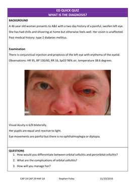 ED QUICK QUIZ WHAT IS the DIAGNOSIS? BACKGROUND a 46 Year Old Woman Presents to A&E with a Two Day History of a Painful, Swollen Left Eye