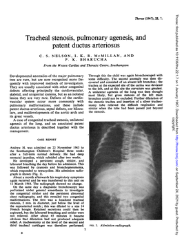 Tracheal Stenosis, Pulmonary Agenesis, and Patent Ductus Arteriosus