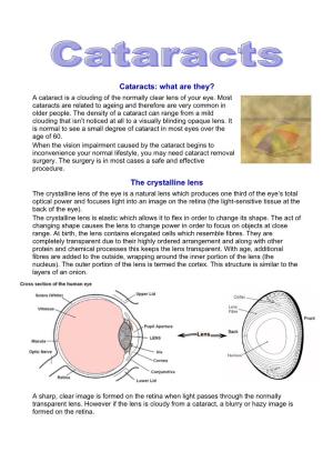 Cataracts: What Are They? the Crystalline Lens