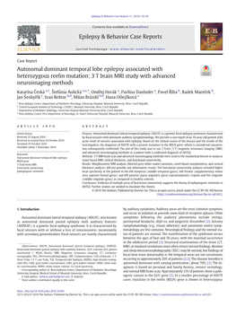 Autosomal Dominant Temporal Lobe Epilepsy Associated with Heterozygous Reelin Mutation: 3 T Brain MRI Study with Advanced Neuroimaging Methods